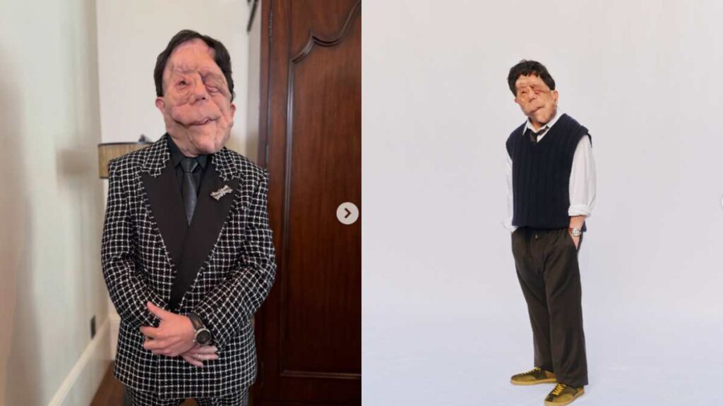 Adam Pearson Biography